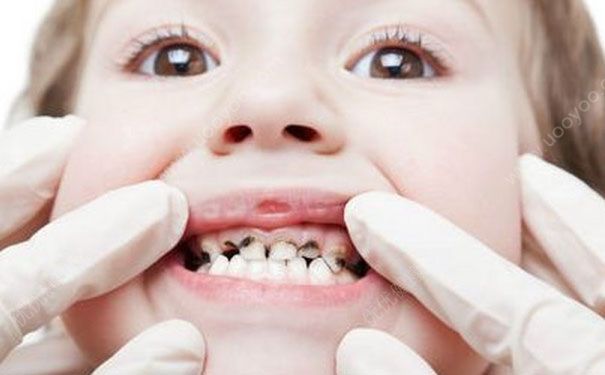 30歲最帥醫(yī)生(shēng)因牙疼去(qù)世 ,你(nǐ)還(hái)敢小(xiǎo)看(kàn)牙疼嗎(ma)?