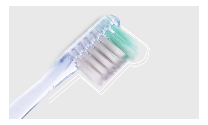 正畸人(rén)士的(de)傾心之選